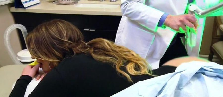 Khloe Kardashian kameralar karşısında kal&ccedil;asına lazer yaptırdı...