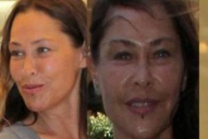 H&uuml;lya Avşar estetiğin dozunu ka&ccedil;ırdı!...