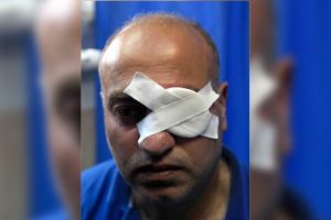 İsrail askerleri Filistinli foto muhabiri g&ouml;z&uuml;nden yaraladı
