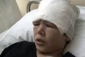 Mert'i yaralayan deneyde &ouml;ğretmene 1 yıla kadar hapis!