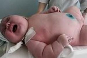 Rekor! 18 kiloluk bebek doğdu!