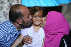 Suriyeli Fatma'nın g&ouml;z&uuml; T&uuml;rk doktorlarında!