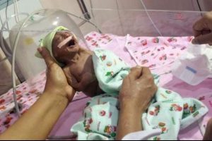 Anne ve baba onu g&ouml;r&uuml;nt&uuml;s&uuml; y&uuml;z&uuml;nden terk etti