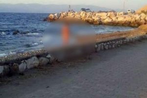 Bursa'da &ccedil;ıplak g&uuml;neşlenince g&ouml;zaltına alındı