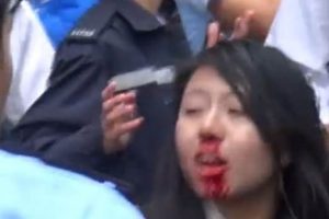 Polise g&ouml;ğ&uuml;sleriyle saldırmaktan h&uuml;k&uuml;m giydi