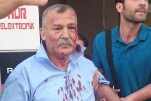 İki saldırıdan sağ kurtuldu