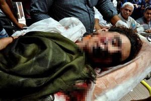 Gen&ccedil; kızın karnında bomba pimi bulundu
