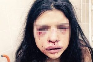 Telefonda inanılmaz s&ouml;zler: 'Anne kurtar &ouml;l&uuml;yorum'
