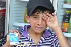 Suriyeli &ccedil;ocuğa saldıran kişi i&ccedil;in şikayette bulunuldu