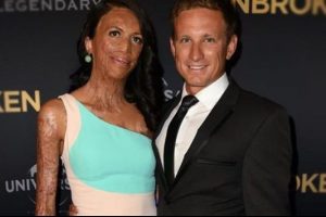 T&uuml;m d&uuml;nyaya ilham veren Turia Pitt ve sevgilisi Michael Hoskin nişanlandı