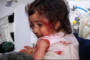 Kazada yaralanan minik Feyza: Kurtar bizi amca