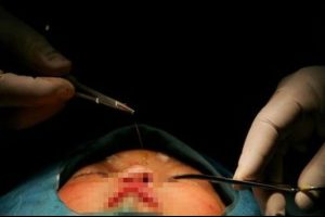 &Ccedil;in: Doktor tarif etti, dedesi 2 g&uuml;nl&uuml;k bebeği &ouml;ld&uuml;rd&uuml;