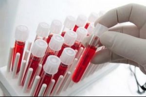 T&uuml;rk doktor buldu! 100 hastalığa...