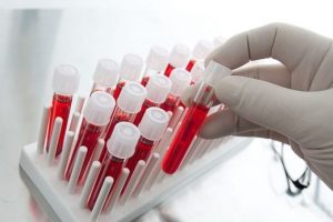 Dikkat! Hepatit vir&uuml;s&uuml; taşıyor olabilirsiniz