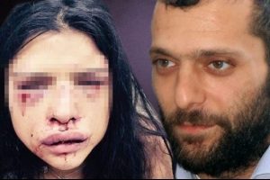 İstek &uuml;zerine Onur &Ouml;zbizerdik hakkındaki uzaklaştırma kaldırıldı