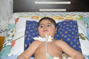 Bursa'da 4 yaşındaki Muhammed nefesini "g&uuml;neş panelinden" alacak