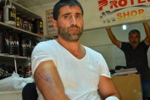 V&uuml;cut şampiyonuna &ouml;ld&uuml;resiye dayak