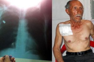 G&ouml;ğs&uuml;ne isabet eden kurşunu taş zannetti