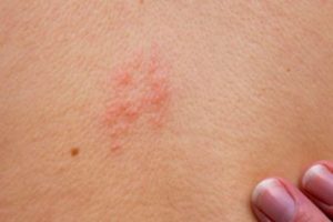 50 yaş &uuml;st&uuml;ndeyseniz mutlaka olun