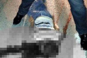 7 yaşındaki &ccedil;ocuk hayatını kaybedince...