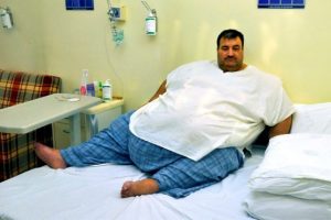Obezliğin nedeni ortaya &ccedil;ıktı!