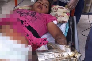 Tarhana &ouml;ğ&uuml;t&uuml;rken kolunu kıyma makinesine kaptırdı
