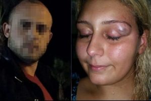 Eski sevgili g&ouml;zaltına alındı