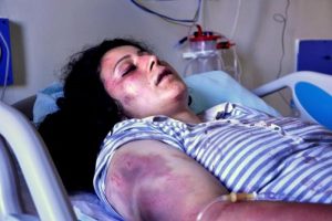 Kurtulmak i&ccedil;in balkondan atladı eve getirip yine d&ouml;vd&uuml;