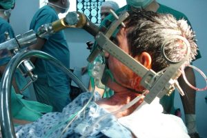 Uyanık kraniyotomi hasta i&ccedil;in daha iyi