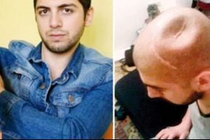 G&uuml;rc&uuml; gencin kolu ve kafatası kırıldı ama kıran yok