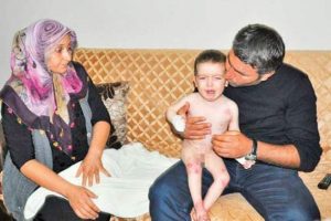 &Ccedil;ocukları g&ouml;zleri &ouml;n&uuml;nde eriyor! Mum hastalığına yakalandı...