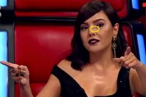 Ebru G&uuml;ndeş'in y&uuml;z&uuml; neden şiş?