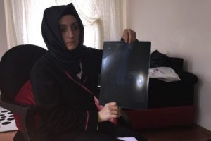 Ameliyat olan kadının karnında mala unuttular!