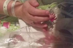 İkizlerden biri doğdu biri anne karnında