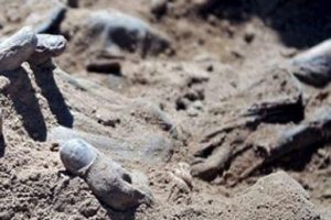 Kesik bacağın altından 46 yıllık bir s&uuml;rpriz &ccedil;ıktı