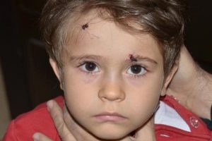 K&ouml;peğin saldırdığı 3 yaşındaki Elif, hastanelik oldu