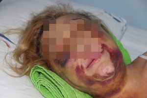 G&uuml;rc&uuml; asıllı kadın, darp edildikten sonra tecav&uuml;ze uğradı