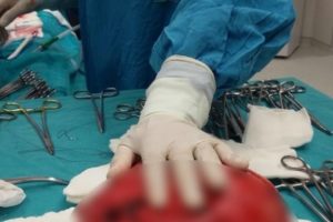 Ordu'da rahminden 6.5 kiloluk ur &ccedil;ıktı