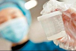 Sperm operasyonu ge&ccedil;iren erkeğe tazminat