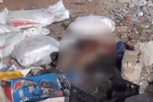 Vahşet: Bacağına 'namus i&ccedil;in' yazdılar