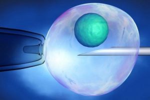 Sperm bankasına '&ouml;jenik' soruşturması