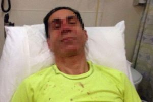 İBB Meclis &uuml;yesi H&uuml;seyin Sağ'ı darp edenlere 9'ar yıl hapis istendi