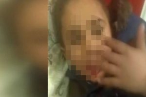 Babasının dilendirip, işkence yaptığı Suriyeli &ccedil;ocuğa devlet sahip &ccedil;ıktı