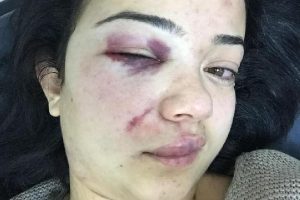 Aydın'da boşandığı eşi, d&ouml;v&uuml;p &ccedil;ocuğunu ka&ccedil;ırdı iddiası