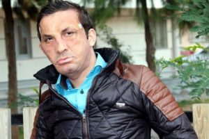 İlk y&uuml;z nakilli Uğur Acar, hastanede tedavi g&ouml;r&uuml;yor