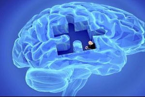 Alzheimer nakil ile bulaşır mı