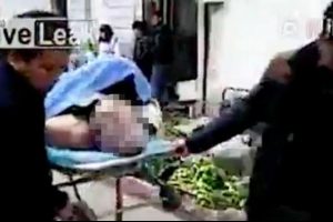 Seks yaparken hayatını kaybetti, ilgin&ccedil; detay sedyede ortaya &ccedil;ıktı