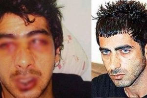 Yunanistan'da polis dayağına 450 bin euro tazminat
