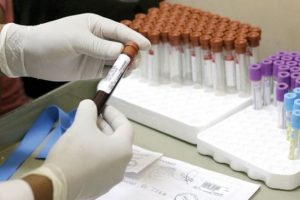 Zika vir&uuml;s&uuml; Venezuela'da 3 can aldı