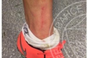 Fenerbah&ccedil;e penaltı pozisyonu sonrası bu fotoğrafı paylaştı!